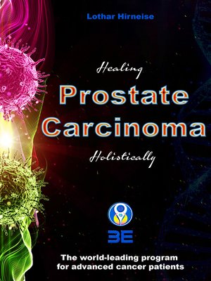 cover image of Prostate Carcinoma